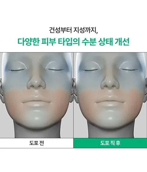 이니스프리 그린티 수분 히알루론산 세럼은 3겹 레이어링 캡슐 히알루론산과 더블 생녹차수를 통해 피부 각질층 15층까지 수분을 전달하고, 외부 열 자극으로 인한 일시적 붉은기 48% 진정 효과를 한데 담았습니다. 물보다 1.4배 빠른 흡수력으로 속건조 갈증을 단숨에 해소하며, 피부과 테스트를 완료한 저자극 포뮬러 기반으로 산뜻한 수분 케어를 선사합니다.