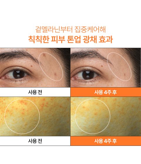 이니스프리 비타민C 캡슐 세럼은 9만 개의 캡슐 포뮬러가 겉 멜라닌 23% 개선 효과를 통해 칙칙한 피부를 정밀 타겟팅합니다. 그린티 엔자임과 스쿠알란을 배합해 묵은 각질 케어와 수분 충전을 동시에 전하며 3중 피부톤을 밝히는 광채 피부를 완성합니다. 미백 기능성 화장품으로 붉은기와 노란기를 포함한 3중 피부톤을 개선 주요 성분 효과를 전달합니다.