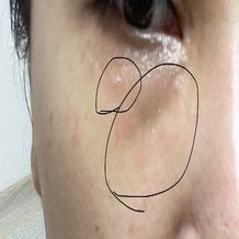 이니스프리 레티놀 PDRN 스킨부스터 앰플은 강력한 그린티 PDRN™과 레티놀의 시너지로 모공결과 속광을 동시에 관리하는 고효능 앰플입니다. 3.4배 더 강력한 흡수력으로 피부 속부터 탄력을 촘촘하게 채워주며, 민감 피부 자극 반응도 0.00의 저자극 포뮬러의 주름 개선 및 미백 2중 기능성 화장품으로, 거칠어진 피부결을 정돈하고 탄력 광채를 선사합니다.