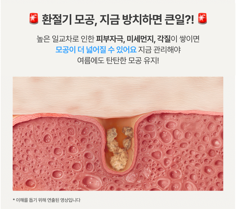 gif 07 사진
