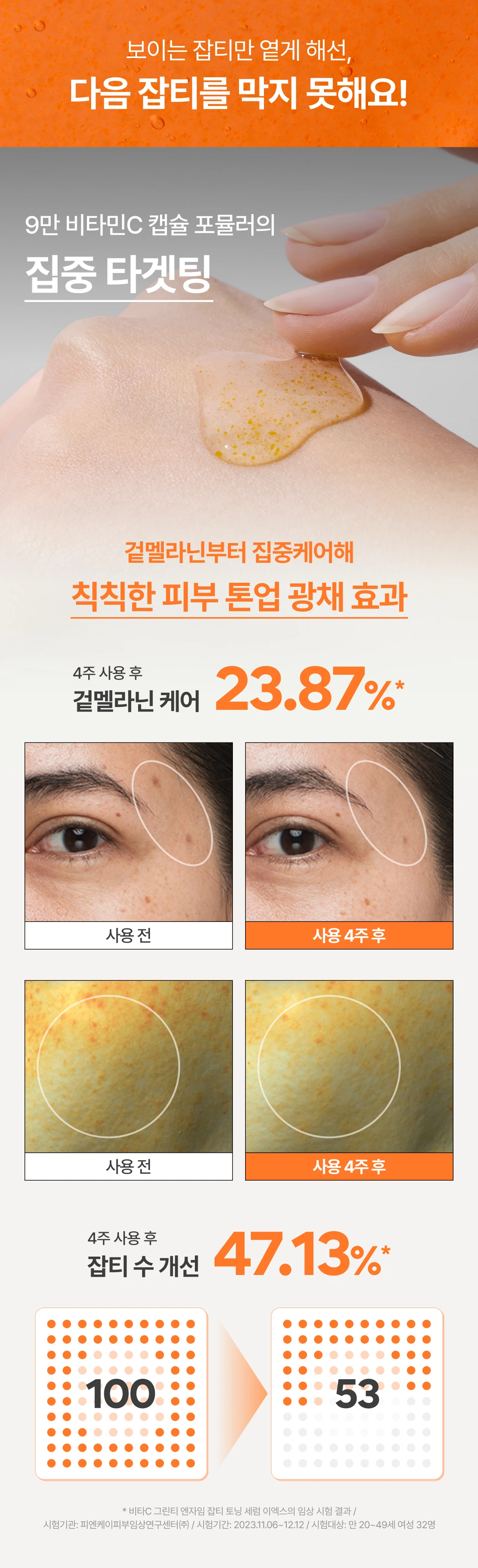 보이는 잡티를 옅게 해선, 다음 잡티를 막지 못해요